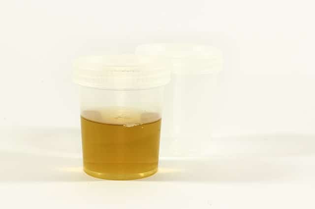 CBD urine